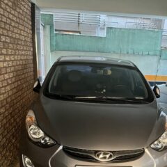 후진 운전 스트레스 후기 이미지